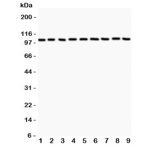 Alpha Catenin Antibody - Western blot testing of alpha Catenin antibody and Lane 1: rat liver; 2: (r) lung; 3: (r) heart; 4: mouse NIH3T3; 5: (r) PC12; 6: human HEPG2; 7: (h) HeLa; 8: (h) MCF-7; 9: (m) HEPA. Expected/observed size ~102KD