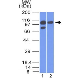 Alpha Catenin Antibody - Western blot testing of human 1) A431 and 2) MCF7 cell lysate with Alpha Catenin antibody (clone 1G5). Expected molecular weight ~102 kDa.