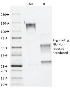 Alpha Catenin Antibody - SDS-PAGE Analysis of Purified, BSA-Free Alpha Catenin Antibody (clone 1G5). Confirmation of Integrity and Purity of the Antibody.