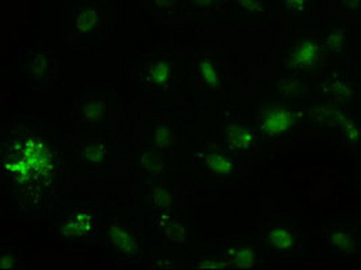 Alpha-Fetoprotein Antibody - Anti-AFP mouse monoclonal antibody  immunofluorescent staining of COS7 cells transiently transfected by pCMV6-ENTRY AFP. (1:100)