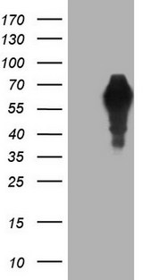 Alpha-Fetoprotein Antibody - HEK293T cells were transfected with the pCMV6-ENTRY control. (Left lane) or pCMV6-ENTRY AFP. (Right lane) cDNA for 48 hrs and lysed