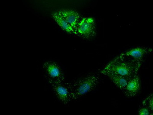 Alpha-Fetoprotein Antibody - Immunofluorescent staining of A549 cells using anti-AFP mouse monoclonal antibody. (1:100)