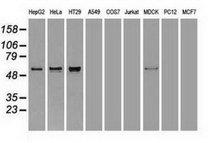 Alpha-Fetoprotein Antibody - Western blot analysis of extracts. (35ug) from 9 different cell lines by using anti-AFP monoclonal antibody. (HepG2: human; HeLa: human; SVT2: mouse; A549: human; COS7: monkey; Jurkat: human; MDCK: canine;rat; MCF7: human). (1:500)