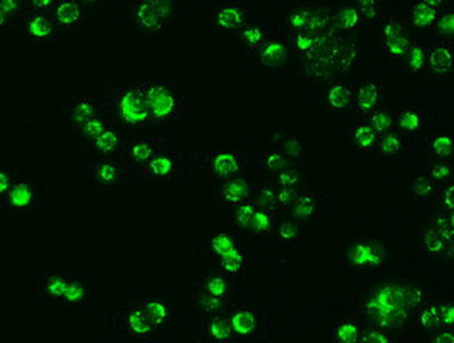 Alpha-Fetoprotein Antibody - Immunofluorescent staining of HT29 cells using anti-AFP mouse monoclonal antibody. (1:100)