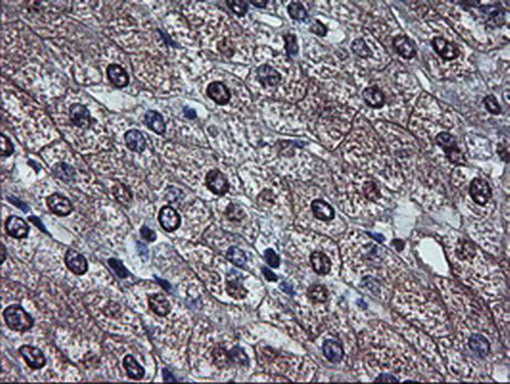 Alpha-Fetoprotein Antibody - Immunohistochemical staining of paraffin-embedded Human liver tissue within the normal limits using anti-AFP mouse monoclonal antibody. (Heat-induced epitope retrieval by 1mM EDTA in 10mM Tris buffer. (pH8.5) at 120°C for 3 min. (1:150)