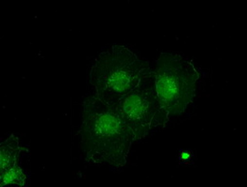 Alpha-Fetoprotein Antibody - Anti-AFP mouse monoclonal antibody  immunofluorescent staining of COS7 cells transiently transfected by pCMV6-ENTRY AFP. (1:100)