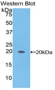 Alpha-Fetoprotein Antibody - Western blot of recombinant AFP / Alpha Fetoprotein.  This image was taken for the unconjugated form of this product. Other forms have not been tested.