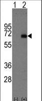 Alpha-Fetoprotein Antibody - Western blot of AFP (arrow) using rabbit polyclonal AFP Antibody. 293 cell lysates (2 ug/lane) either nontransfected (Lane 1) or transiently transfected with the AFP gene (Lane 2) (Origene Technologies).