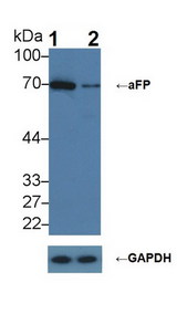 Alpha-Fetoprotein Antibody - Knockout Varification: Lane 1: Wild-type HepG2 cell lysate; Lane 2: aFP knockout HepG2 cell lysate; Predicted MW: 69kDa ; Observed MW: 70kDa; Primary Ab: 2µg/ml Rabbit Anti-Human aFP Ab; Second Ab: 0.2µg/mL HRP-Linked Caprine Anti-Rabbit IgG Polyclonal Antibody;