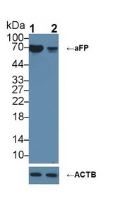 Alpha-Fetoprotein Antibody - Knockout Varification: Lane 1: Wild-type HepG2 cell lysate; Lane 2: aFP knockout HepG2 cell lysate; Predicted MW: 69kDa Observed MW: 69kDa Primary Ab: 2µg/ml Rabbit Anti-Human aFP Antibody Second Ab: 0.2µg/mL HRP-Linked Caprine Anti-Rabbit IgG Polyclonal Antibody