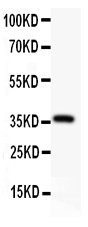 Alpha-Fetoprotein Antibody - AFP antibody Western blot. All lanes: Anti AFP at 0.5 ug/ml. WB: Human Recombinant AFP Protein 0.5ng. Predicted band size: 36 kD. Observed band size: 36 kD.