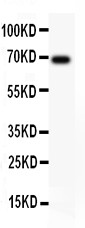 Alpha-Fetoprotein Antibody - AFP antibody Western blot. All lanes: Anti AFP at 0.5 ug/ml. WB: HEPG2 Whole Cell Lysate at 40 ug. Predicted band size: 69 kD. Observed band size: 69 kD.