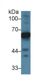 Alpha-Fetoprotein Antibody - Western Blot; Sample: Rat Cerebrum lysate; Primary Ab: 2µg/ml Rabbit Anti-Rat aFP Antibody Second Ab: 0.2µg/mL HRP-Linked Caprine Anti-Rabbit IgG Polyclonal Antibody