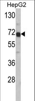 Alpha-Fetoprotein Antibody - Western blot of AFP Antibody in HepG2 cell line lysates (35 ug/lane). AFP (arrow) was detected using the purified antibody.
