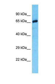 Alpha-Fetoprotein Antibody - Western blot of Human Fetal Brain. AFP antibody dilution 3.0 ug/ml.  This image was taken for the unconjugated form of this product. Other forms have not been tested.