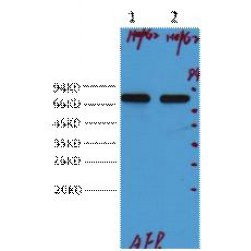 Alpha-Fetoprotein Antibody - Western blot of AFP alpha 1 Fetoprotein antibody