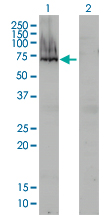 Alpha-Fetoprotein Antibody - Western Blot analysis of AFP expression in transfected 293T cell line by AFP monoclonal antibody (M01), clone 1G7.Lane 1: AFP transfected lysate(69 KDa).Lane 2: Non-transfected lysate.