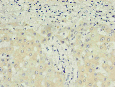 Alpha-Fetoprotein Antibody - Immunohistochemistry of paraffin-embedded human liver using product in 30ug/ml dilute concentrations.