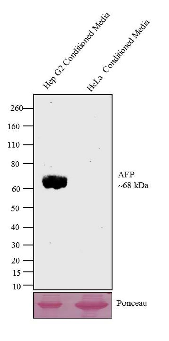 Alpha-Fetoprotein Antibody - AFP Antibody in Western Blot (WB)