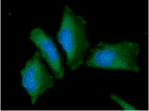 Alpha-Fetoprotein Antibody - ICC/IF analysis of AFP in HaLe cells. The cell was stained with AFP antibody (1:100).The secondary antibody (green) was used Alexa Fluor 488. DAPI was stained the cell nucleus (blue).