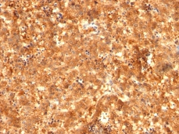 Alpha-Fetoprotein Antibody - Formalin-fixed, paraffin-embedded human fetal liver stained with AFP antibody (C2 + C3 + MBS-12).  This image was taken for the unmodified form of this product. Other forms have not been tested.