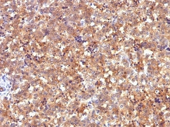 Alpha-Fetoprotein Antibody - Formalin-fixed, paraffin-embedded human fetal liver stained with Alpha Fetoprotein antibody (C2).  This image was taken for the unmodified form of this product. Other forms have not been tested.