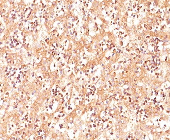 Alpha-Fetoprotein Antibody - Alpha Fetoprotein antibody immunohistochemistry This image was taken for the unmodified form of this product. Other forms have not been tested.