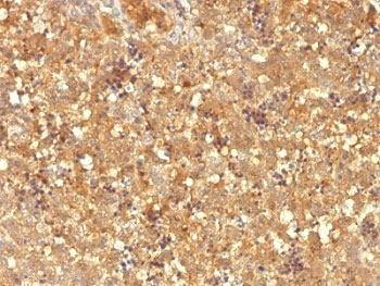 Alpha-Fetoprotein Antibody - Formalin-fixed, paraffin-embedded human fetal liver stained with AFP antibody (MBS-12).  This image was taken for the unmodified form of this product. Other forms have not been tested.