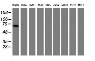 Alpha-Fetoprotein Antibody - Western blot of extracts (35 ug) from 9 different cell lines by using g anti-AFP monoclonal antibody (HepG2: human; HeLa: human; SVT2: mouse; A549: human; COS7: monkey; Jurkat: human; MDCK: canine; PC12: rat; MCF7: human).