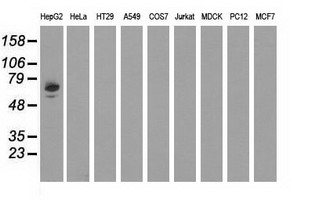 Alpha-Fetoprotein Antibody - Western blot analysis of extracts (35ug) from 9 different cell lines by using anti-AFP monoclonal antibody.