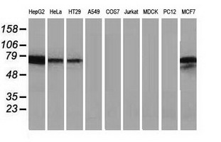 Alpha-Fetoprotein Antibody - Western blot of extracts (35 ug) from 9 different cell lines by using anti-AFP monoclonal antibody.