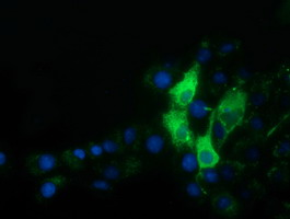 Alpha-Fetoprotein Antibody - Anti-AFP mouse monoclonal antibody  immunofluorescent staining of COS7 cells transiently transfected by pCMV6-ENTRY AFP.