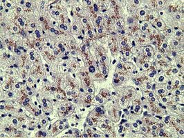 Alpha-Fetoprotein Antibody - IHC of paraffin-embedded Human liver tissue using anti-AFP mouse monoclonal antibody.