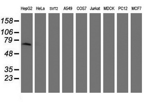Alpha-Fetoprotein Antibody - Western blot of extracts (35 ug) from 9 different cell lines by using g anti-AFP monoclonal antibody (HepG2: human; HeLa: human; SVT2: mouse; A549: human; COS7: monkey; Jurkat: human; MDCK: canine; PC12: rat; MCF7: human).