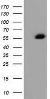 Alpha-Fetoprotein Antibody - HEK293T cells were transfected with the pCMV6-ENTRY control (Left lane) or pCMV6-ENTRY AFP (Right lane) cDNA for 48 hrs and lysed. Equivalent amounts of cell lysates (5 ug per lane) were separated by SDS-PAGE and immunoblotted with anti-AFP.
