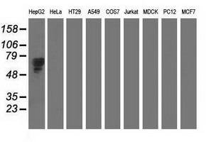 Alpha-Fetoprotein Antibody - Western blot of extracts (35 ug) from 9 different cell lines by using anti-AFP monoclonal antibody.