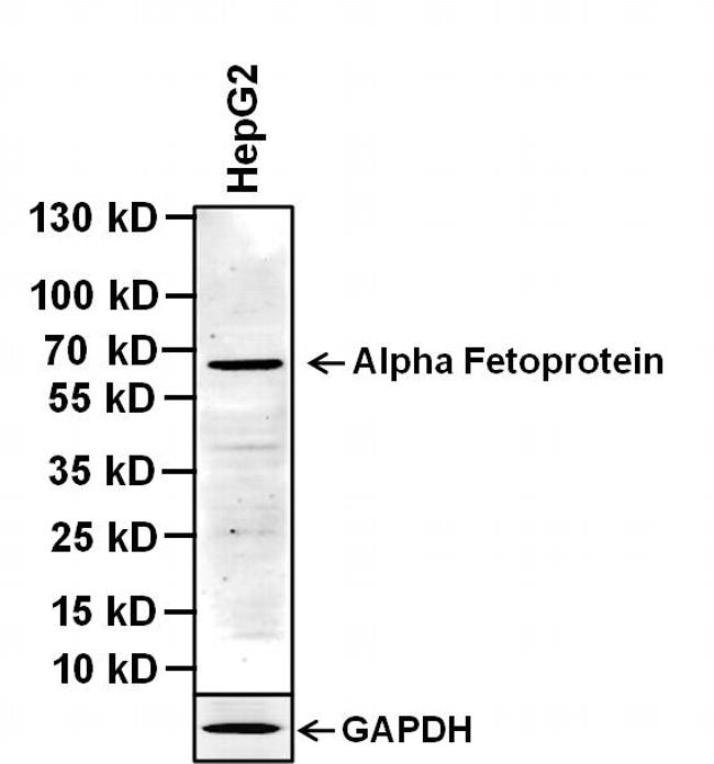Alpha-Fetoprotein Antibody - Western blot analysis of alpha-fetoprotein was performed by loading 40ug of the indicated whole cell lysates and 5ul of PageRuler Plus Prestained Protein Ladder per well onto a 4-20% Tris-Glycine polyacrylamide gel. Proteins were transferred to a nitrocellulose membrane using the G2 Blotter, and blocked with 5% BSA in TBST for 1 hour at room temperature. Alpha-fetoprotein was detected at ~67kDa using a alpha-fetoprotein mouse monoclonal antibody at a concentration of 2 µg/mL in blocking buffer overnight at 4C on a rocking platform, followed by a Goat anti-Mouse IgG (H+L) Superclonal Secondary Antibody, HRP conjugate at a dilution of 1:1000 for at least 30 minutes at room temperature. Chemiluminescent detection was performed using SuperSignal West Pico.