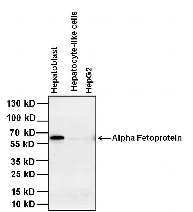 Alpha-Fetoprotein Antibody - Western blot analysis of alpha-fetoprotein was performed by loading 20ug of the indicated whole cell lysates and 5ul of PageRuler Plus Prestained Protein Ladder per well onto a 4-20% Tris-Glycine polyacrylamide gel. Proteins were transferred to a nitrocellulose membrane using the G2 Blotter, and blocked with 5% BSA in TBST for 1 hour at room temperature. Alpha-fetoprotein was detected at ~67kDa using a alpha-fetoprotein mouse monoclonal antibody at a concentration of 2 µg/mL in blocking buffer for 1 hour at room temperature on a rocking platform, followed by a Goat anti-Mouse IgG (H+L) Superclonal Secondary Antibody, HRP conjugate at a dilution of 1:1000 for at least 30 minutes at room temperature. Chemiluminescent detection was performed using SuperSignal West Pico.