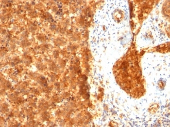 Alpha-Fetoprotein Antibody - Formalin-fixed, paraffin-embedded human fetal liver stained with AFP antibody (SPM334).  This image was taken for the unmodified form of this product. Other forms have not been tested.