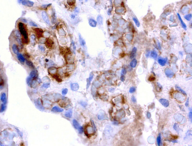 Alpha-Fetoprotein Antibody - Immunohistochemical staining of paraffin-embedded human placenta using anti-AFP clone UMAB66 mouse monoclonal antibody at 1:200 dilution of 0.8mg/mL and detection with Polink2 Broad HRP DAB.requires heat-induced epitope retrieval with citrate pH6.0 at 95-100C 20 minutes. The image shows strong membranous, cytoplasmic and rare nuclear protein in the trophoblast cells. This protein is also seen as secreted protein.