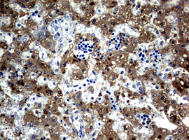 Alpha-Fetoprotein Antibody - Immunohistochemical staining of paraffin-embedded human embryonic liver tissue using anti-AFP mouse monoclonal antibody. Heat-induced epitope retrieval by 10mM citric buffer, pH6.0, 120C for 3min in pressure chamber/cooker.diluted 1:100 and detection shown with HRP enzyme and DAB chromogen. Strong cytoplasmic and membranous staining is seen in the hepatocytes.