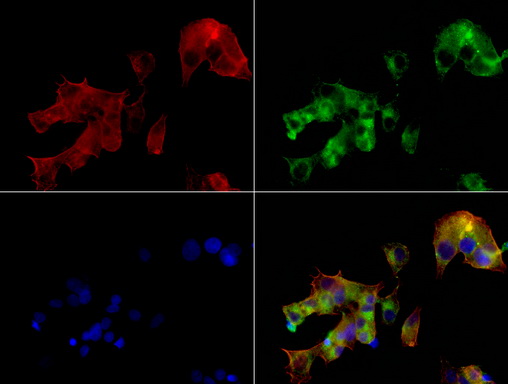 Alpha-Fetoprotein Antibody - Immunofluorescent staining of HepG2 cells using AFP mouse monoclonal antibody  green). Actin filaments were labeled with TRITC-phalloidin. (red), and nuclear with DAPI. (blue). The three-color overlay image is located at the bottom-right corner.