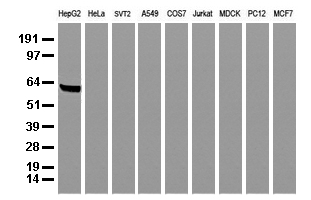 Alpha-Fetoprotein Antibody - Western blot analysis of extracts. (35ug) from 9 different cell lines by using anti-AFP monoclonal antibody. (Clone UMAB66).