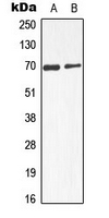 Alpha-Fetoprotein Antibody - Western blot analysis of Alpha-fetoglobulin expression in HepG2 (A); mouse liver (B) whole cell lysates.