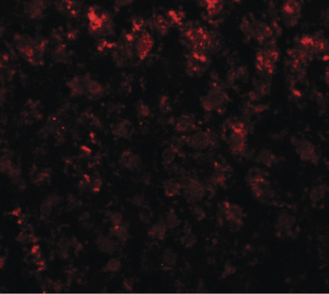Alpha-Fetoprotein Antibody - Immunofluorescence of AFP in rat liver tissue with AFP antibody at 20 ug/ml.