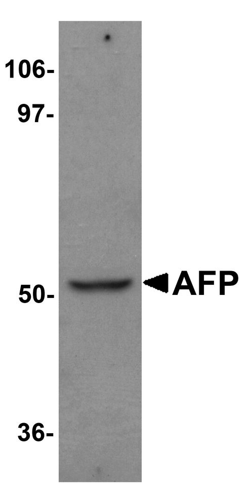 Alpha-Fetoprotein Antibody - Western blot analysis of AFP in human liver tissue lysate with AFP antibody at 1 ug/ml.