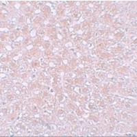 Alpha-Fetoprotein Antibody - Immunohistochemistry of AFP in rat liver tissue with AFP antibody at 10 µg/mL.