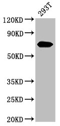 Alpha-Fetoprotein Antibody - Western Blot Positive WB detected in: 293T whole cell lysate All lanes: AFP antibody at 3.2µg/ml Secondary Goat polyclonal to rabbit IgG at 1/50000 dilution Predicted band size: 69 kDa Observed band size: 69 kDa