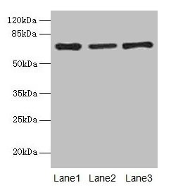 Alpha-Fetoprotein Antibody - Western blot All lanes: Alpha-fetoprotein antibody at 10µg/ml Lane 1: HepG2 whole cell lysate Lane 2: Rat liver tissue Lane 3: 293T whole cell lysate Secondary Goat polyclonal to rabbit IgG at 1/10000 dilution Predicted band size: 67 kDa Observed band size: 67 kDa