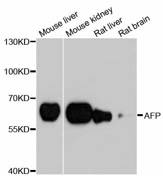 Alpha-Fetoprotein Antibody - Western blot analysis of extracts of various cell lines, using AFP antibody at 1:1000 dilution. The secondary antibody used was an HRP Goat Anti-Rabbit IgG (H+L) at 1:10000 dilution. Lysates were loaded 25ug per lane and 3% nonfat dry milk in TBST was used for blocking. An ECL Kit was used for detection and the exposure time was 40s.